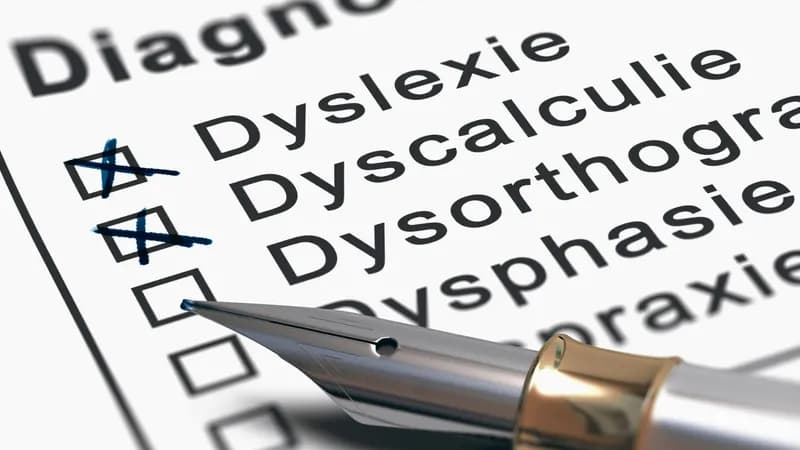 DYS